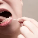 Haruskah saya khawatir tentang flossing?