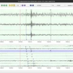 Kepala Pusat Gempabumi dan Tsunami BMKG: Sekitar pukul 21.01 WIB Apakah di Cirebon Rasakan Gempa?